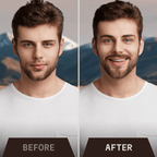 Beard Growth Kit - Sandalwood Beard Biotin Growth Oil & Derma Roller